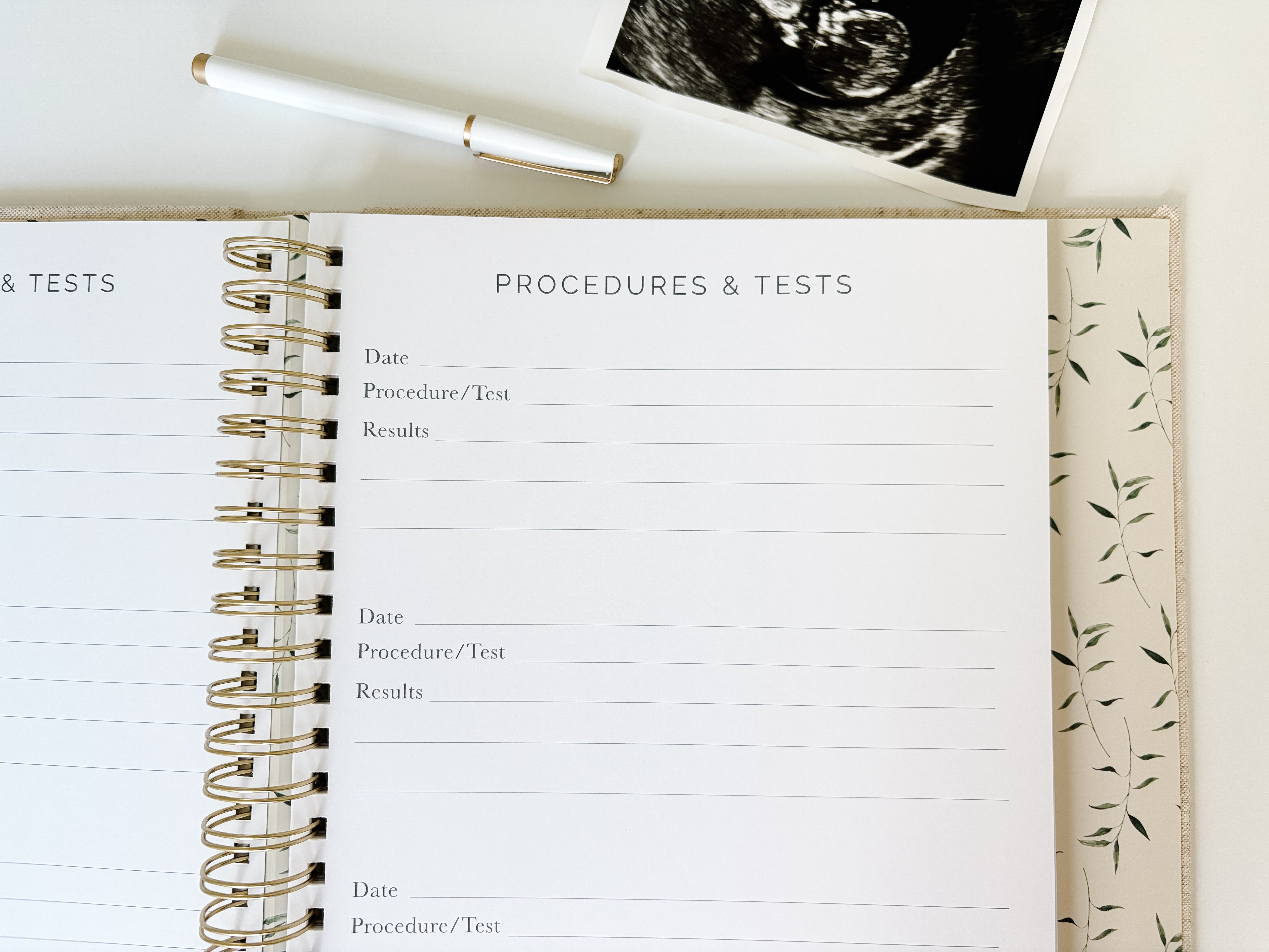 IVF Pregnancy Journal