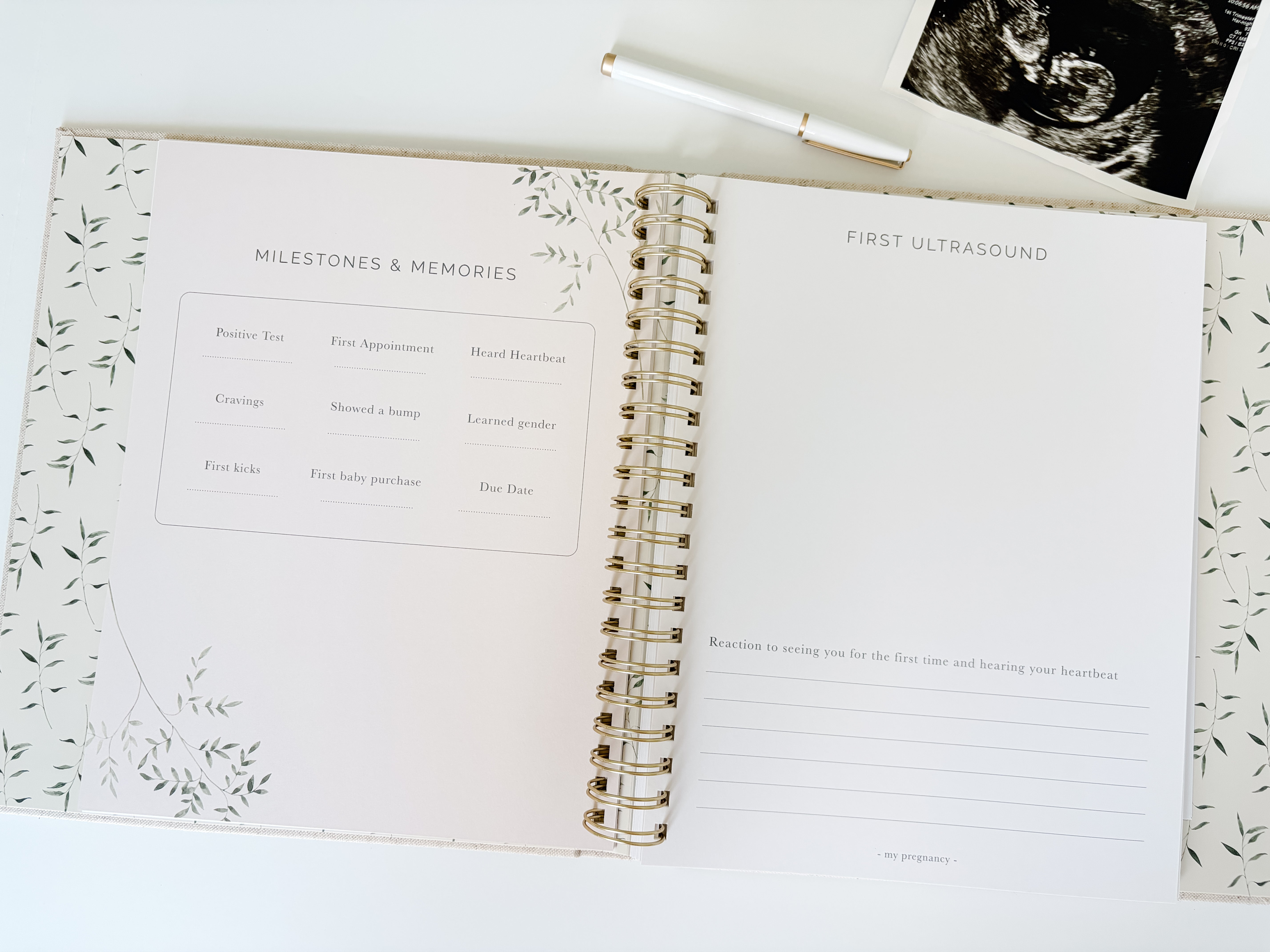 IVF Pregnancy Journal