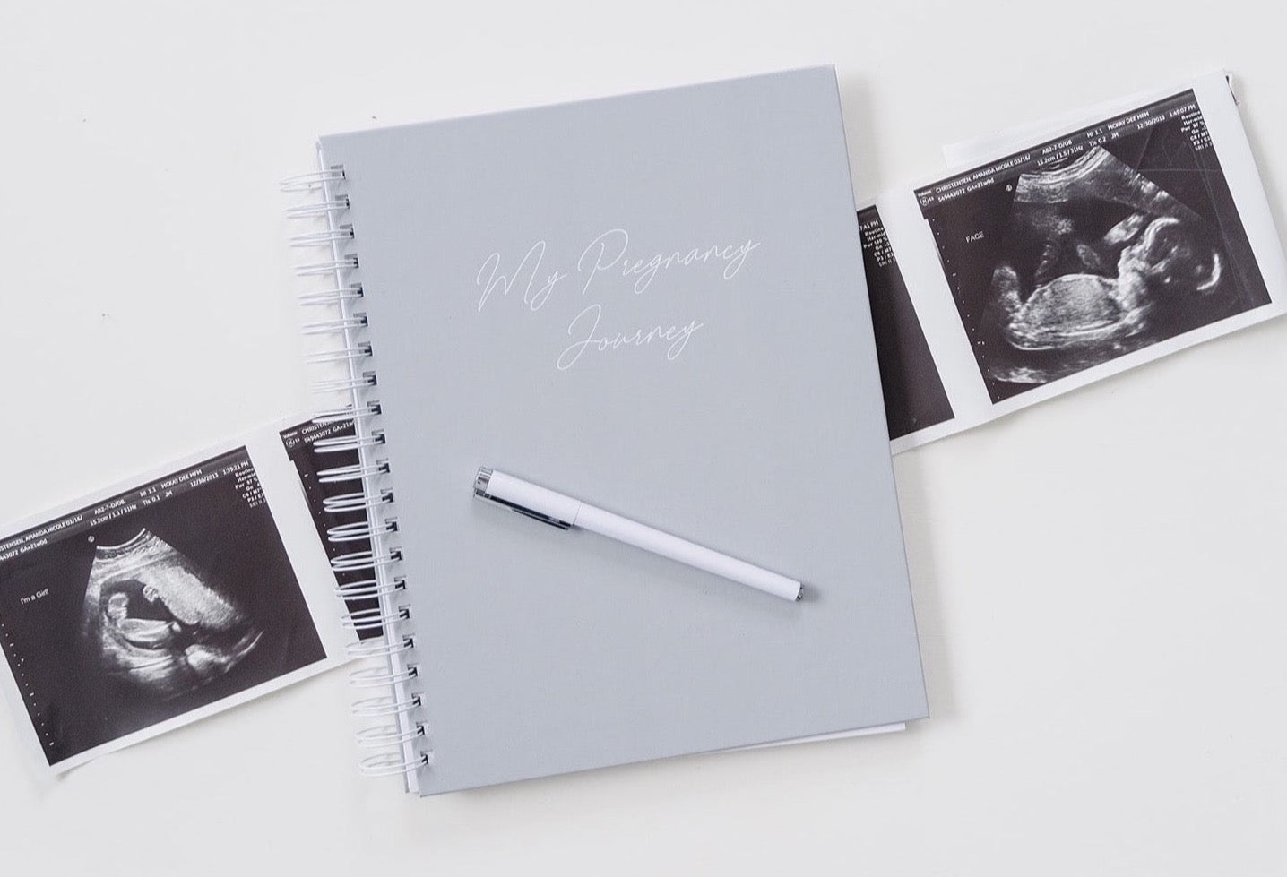 pregnancy journal