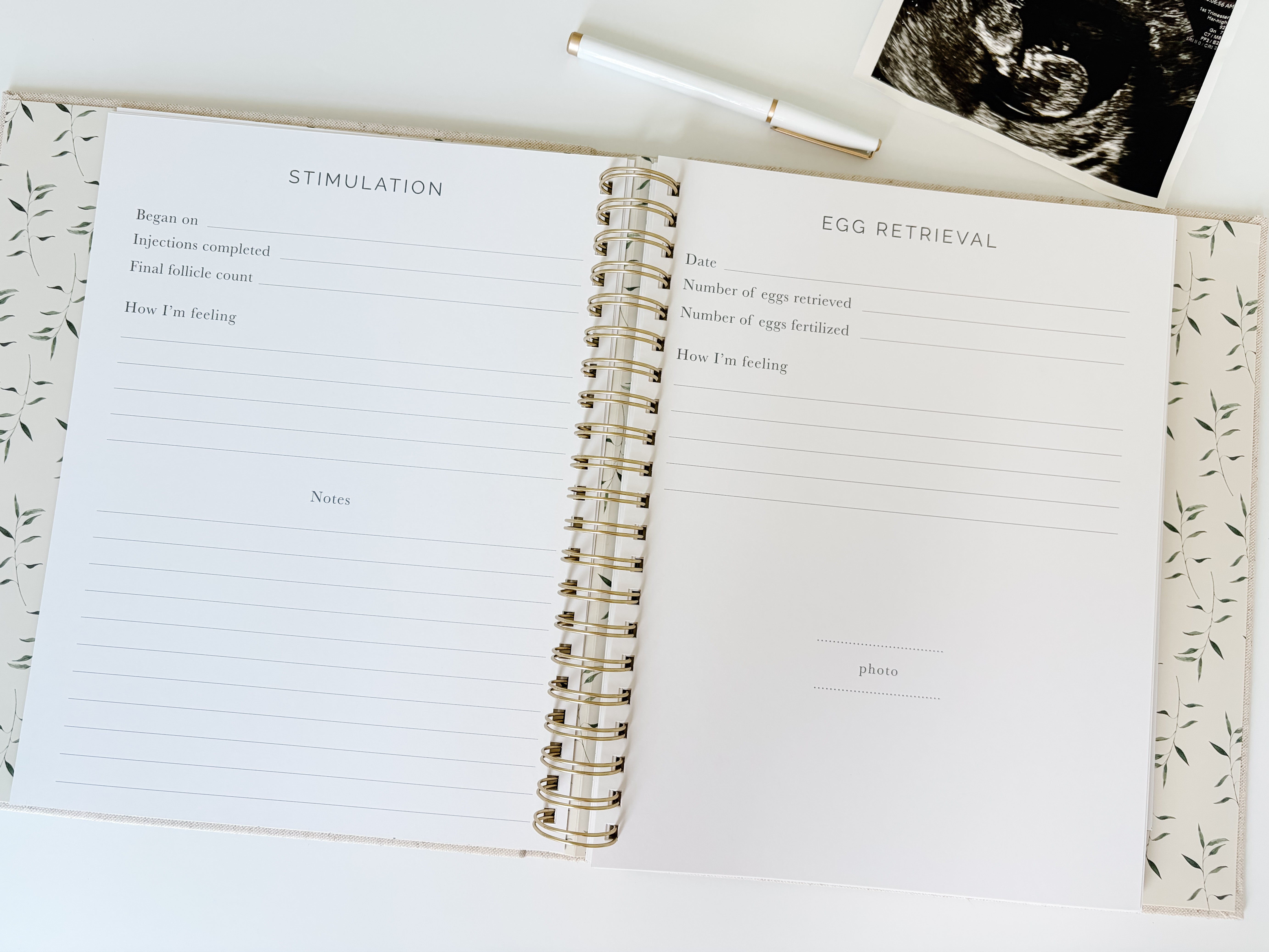 IVF Pregnancy Journal