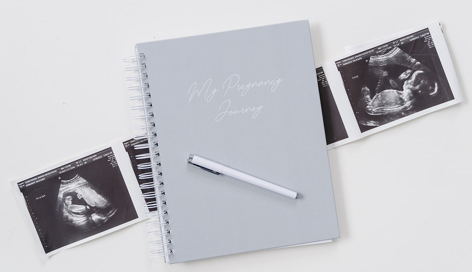 Pregnancy Journal - Classic